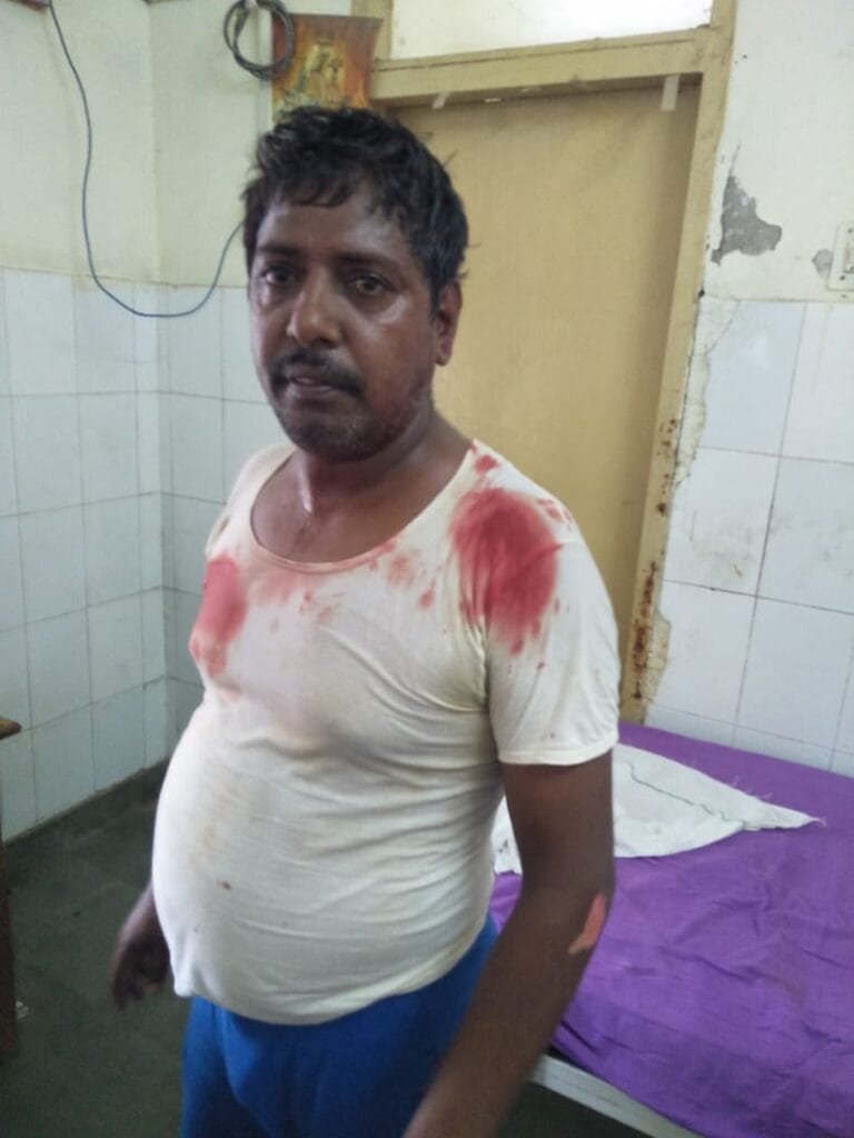 BREAKING: पुतली मोड पर मोटरसाइकिल में भिड़ंत, तीन घायल 1 IMG 20210802 WA0009 1