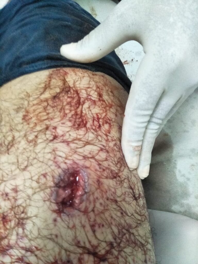 BIG BREAKING: KOTPUTLI स्कूल व्याख्याता को गोली मारी, हमलावर फरार 1 IMG 20210805 WA0013