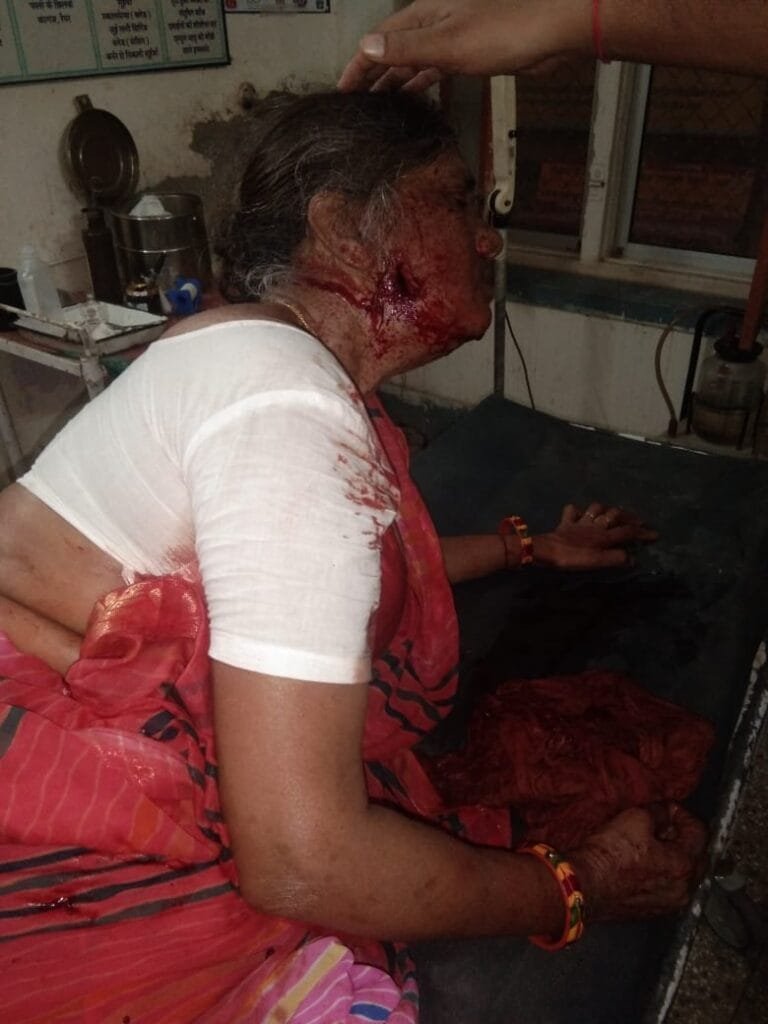 पावटा : बंदूक की नोंक पर घरों में लूटपाट, महिला के जबड़े में लगी गोली, युवक भी घायल 1 IMG 20220831 WA0001
